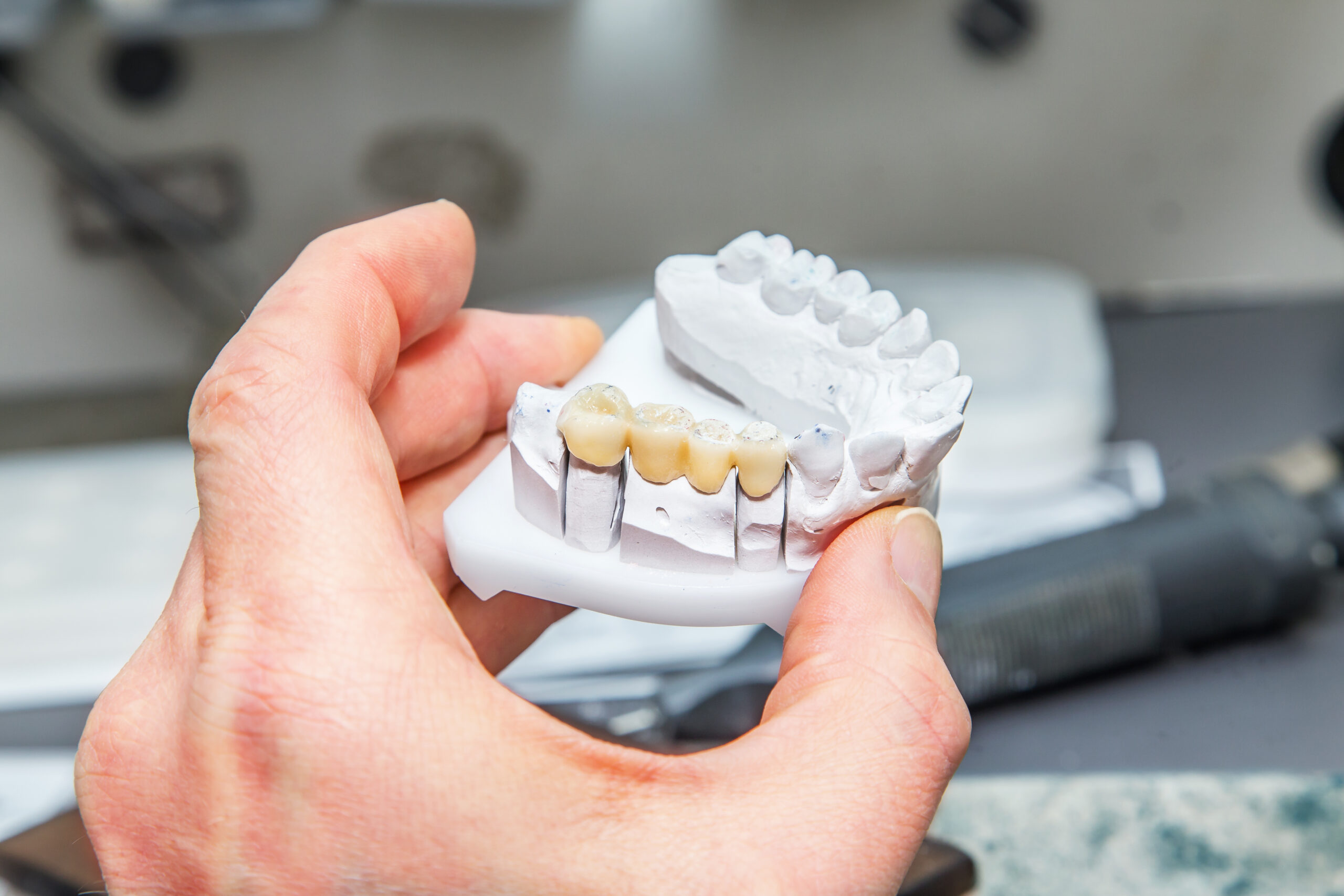 Technical shots of model on a dental prothetic laboratory.Dentist hand with plaster model and ceramic dentures