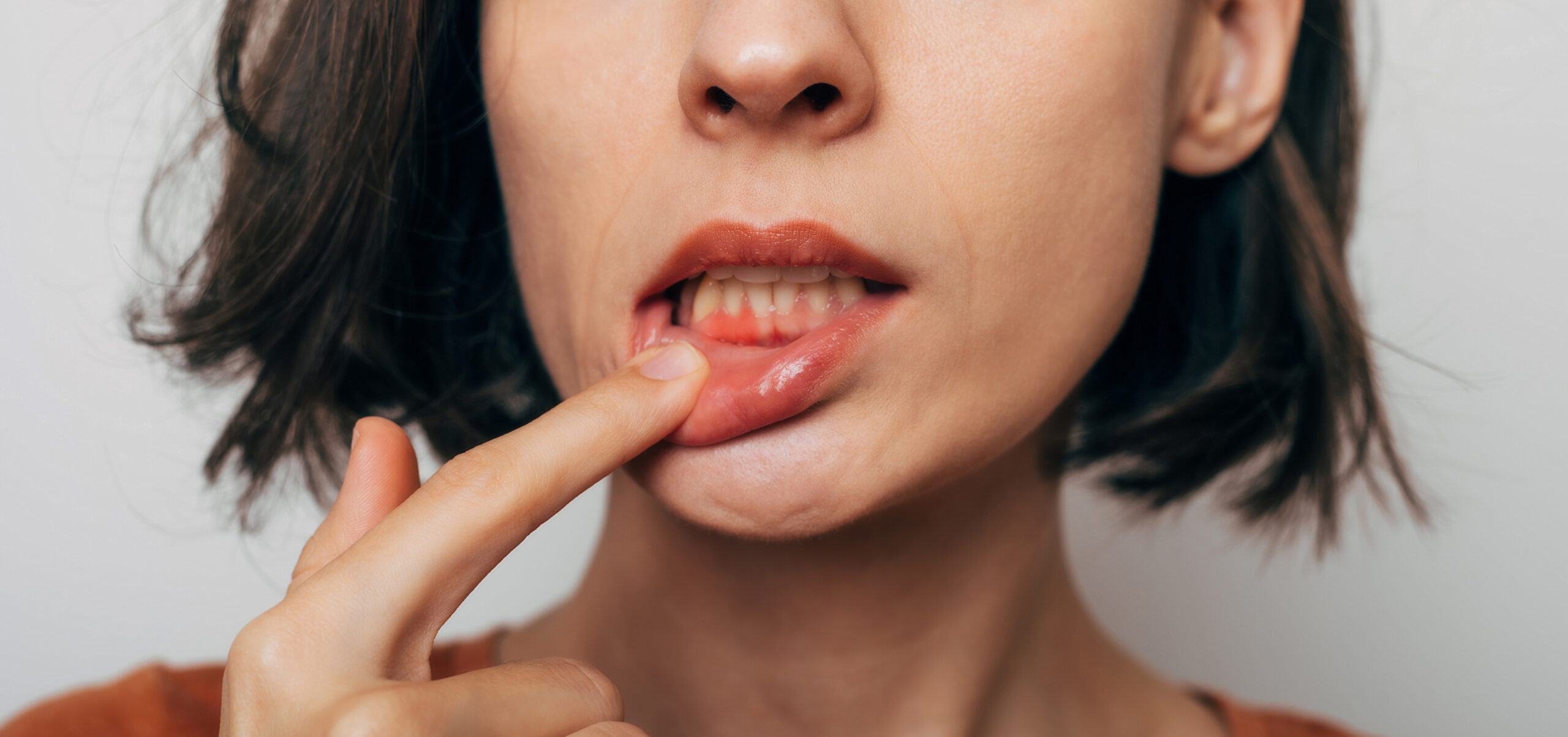AdobeStock 543725597 scaled - South Hills Dental